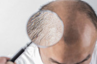 잠 안 올 때 찾던 멜라토닌, 탈모 치료에도 효과?