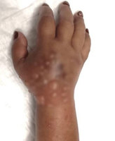 ���յ ��ߺұ� �����̡��� 50�� ҳ, CT ��� �� ���� ��?