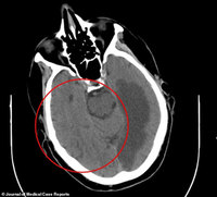 ���������� ������ �� �Ӹ��� �����١��� ���� ���� �ǽɹ��� 70..