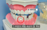 ����ġ �߸� �ϰ� �־��ס� �Կ��� ���� ���� ���� ������?