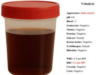 ����ħ�� �Ͼ �Һ� ����, �˺��������� 30�� ҳ, ���� ��ȣ��..