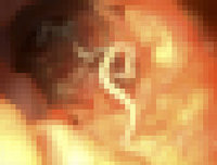 ���� �ȿ��� ���� �ڶ󵵷� �� ���ѡ��� ��ü �� �̷� ����?