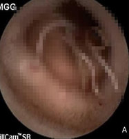 ����� ���� �������ϡ� �忡 ���̰͡� �پ��־��١� 40�� ҳ, ��..