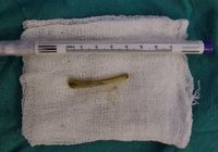 "�̰� �� ��ӿ�" 60�� ���� ������ �θ� '�̰�'�� ����..