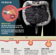 "���ð��غ��� ���忡 ���� �ִ���"�� �� ���� ���, ���� '..