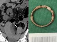 50�� ��, �ӽ� �������� �� ������ ���� ��?