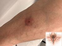 ����� �������µ����� 80�� �� ������ �߰ߵ� ���� ������