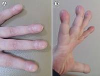 ����� �ǽɡ��� �ճ��� ���� �� �� �ִٰ�?