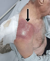 ���� ġ�ᡯ �� �� �߸� �޾Ҵٰ��� ��� �� ��Ƴ��� 60�� ��, ..