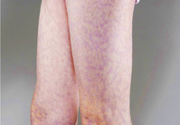 �߿� �� �Ǻο� ���� ���̡� ���δٸ�, ������ ��ȯ ��ȣ