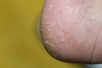 ���� �����