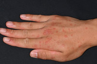 ���յ��� ��ߺұߡ��� ���� �� ���� �޴� ��� ���� ���