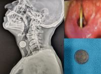 �� �԰� �� �峭�ε��� �� ���̰͡� ���� ��Ҹ� �� ���� ��, ..