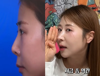 �ڼ���, ��� �޶��� ����� ���� ���� ������ �� �޾Ҵٴ���?