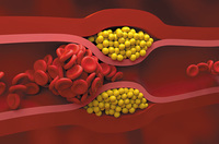 ���� �����