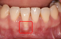 ���� �����