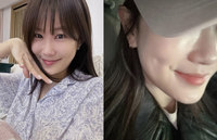 김지민, “넘어진 뒤로 ‘보조개’ 생겼다”… 모습 봤더니?