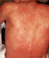 ���㸮 ������ ���̰͡� ����ߴٰ����� 80�� �� �Ǻ�, ��ü ����..