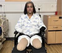 “사지 절단하고 심정지 6번” 50대 女… 반려견의 뽀뽀가 문제였다