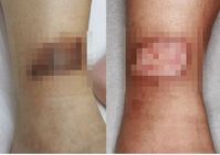 ������ �� �Ӹ� �ÿ� �δ� ���� ���ǡ�, ���� ���衱�� ������ ��..