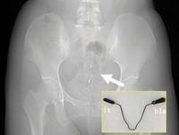 ������ �� ���� �ؽɡ� 30�� ҳ, �汤�� ���̰͡� �İ������