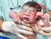 신생아 손에 들린 저것, 뭐지? “피임 장치도 나를 못 막았다”