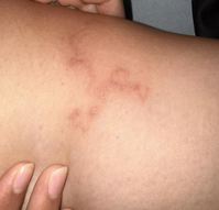 ������ �� �� ���� �����̡��� ��Ʋ��� �Ǻ�, ��ü ���� ��?