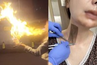 �� �����, ���� ������ ���� ç�������ϴٰ� �󱼿� ȭ�� ����..