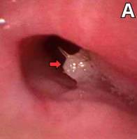 ���� ���� �����Ϳ� �ִ� 7���� �Ʊ�, �񱸸����� ���̰͡� ��