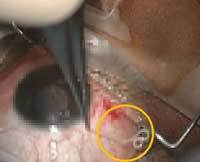 ����Ʋ��Ʋ ���� ���ٳ�䡱 20�� ҳ, ������ ���̰͡� �߰ߡ�..