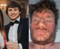 ‘믿었던 연고의 배신’ 전신 진물 탓, 아내 출산도 못 지킨 20대 男..