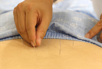 “척추관 협착증 한의통합치료, 수술 막고 진통제 사용률 낮춘다”