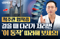 [질병백과 TV] 척추관 협착증, 걸을 때 다리가 저리다면 ‘이 동작’ 따라 해보세요