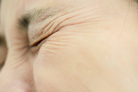 눈·입 마르는 쇼그렌증후군… 환자들 겪는 가장 큰 고통은?