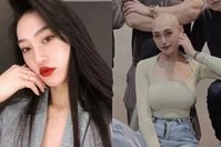 “무거운 것 들고 생긴 근육통인줄” 골든타임 놓쳐 사망한 인플루언서, 무슨 병?