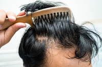 Z세대, 머리 ‘이렇게’ 감는다던데… 탈모 부르는 방법?