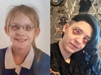 “눈 감지도 뜨지도 못 하는 고통”… 눈꺼풀 거대한 종양, 원인은?