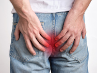 운동 후 더 괴롭다? 남성들 항문 가려운 이유