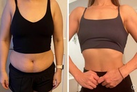 “8개월만, 22kg 감량”… 30대 女, 좋아하던 ‘이것’ 끊고 성공