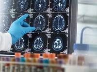 ���� ġ���� ������衦 �����ӱⰣ ��� ġ�� ���� �������١�..