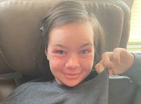 �Ǻ� �������� ���� �ջ� ���޺����� ������ �� �Ǵ� 20�� ҳ