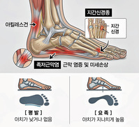 4월, 다시 뛰는 발바닥이 보내는 '찌릿한' 경고