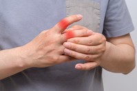 2030 통풍 늘었다… 치킨 말고, 끊어내야 할 것은?