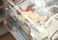 쌍둥이 분만에 8명 필요… 현실은 당직 의사 1명이 전부