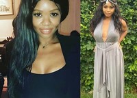 20대 변호사, 성형수술 받다가 사망… 대체 무슨 일?