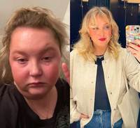 “외출 때 와인 한 병 꼭 챙겨” 20대 중독 女… ‘사망 선고’ 후 생긴 변화 보니?