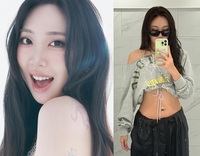 이영지, ‘처음이자 마지막’ 성형 고백… “4년 고민 끝 ‘이 시술’ 했다”