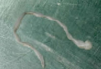 “뇌 속에 8cm 기생충”… 60대 女, ‘이것’ 먹었던 게 화근