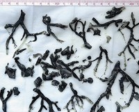 숨 못 쉬던 80대, 폐 속에서 ‘검은 덩어리’ 나와… 정체는?