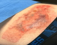 “신장 망가뜨렸다”… 전문가 경고한 ‘이 물건’, 대체 뭐야?